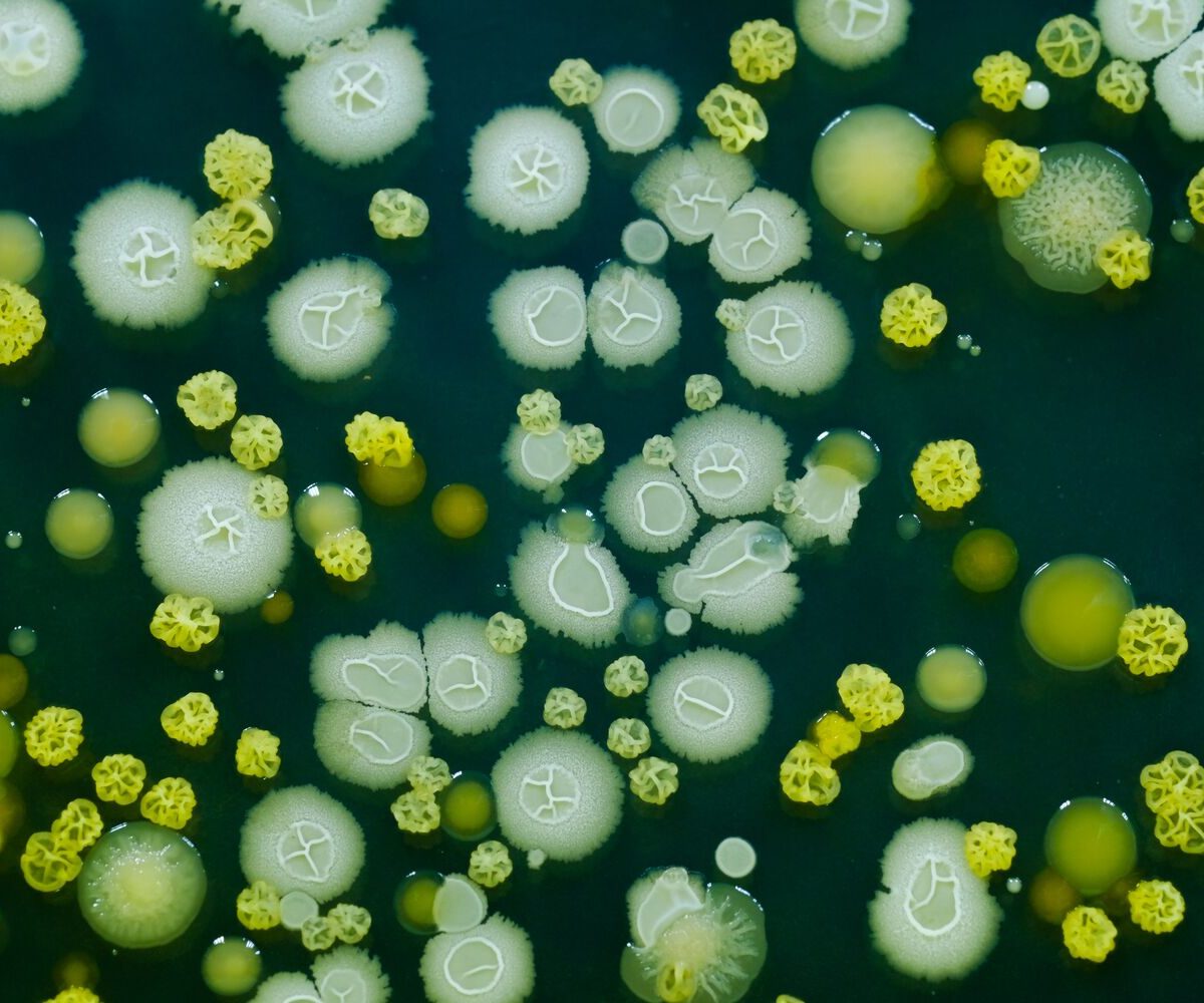 „The virulence potential of Prototheca microalgae explored by in vitro infection model”