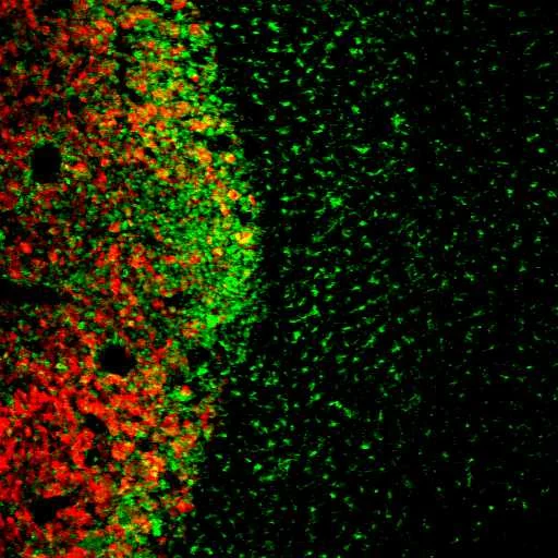 VPS10P receptors in brain dieseases